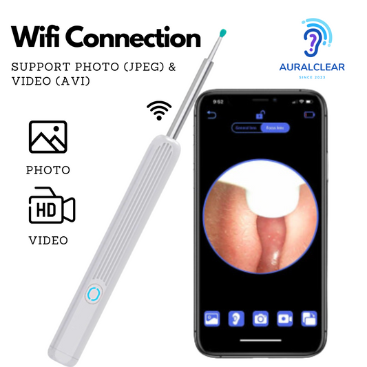 Aural Clear Wifi Ear Wax Removal Pro Cleaner
